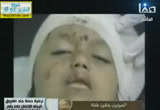 التعرض لأنساب الصحابة رضي الله عنهم( 7/11/2013)حملة جند الفاروق 